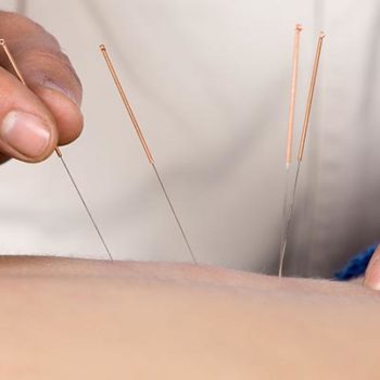 Acupuncture Lawrenceville NJ